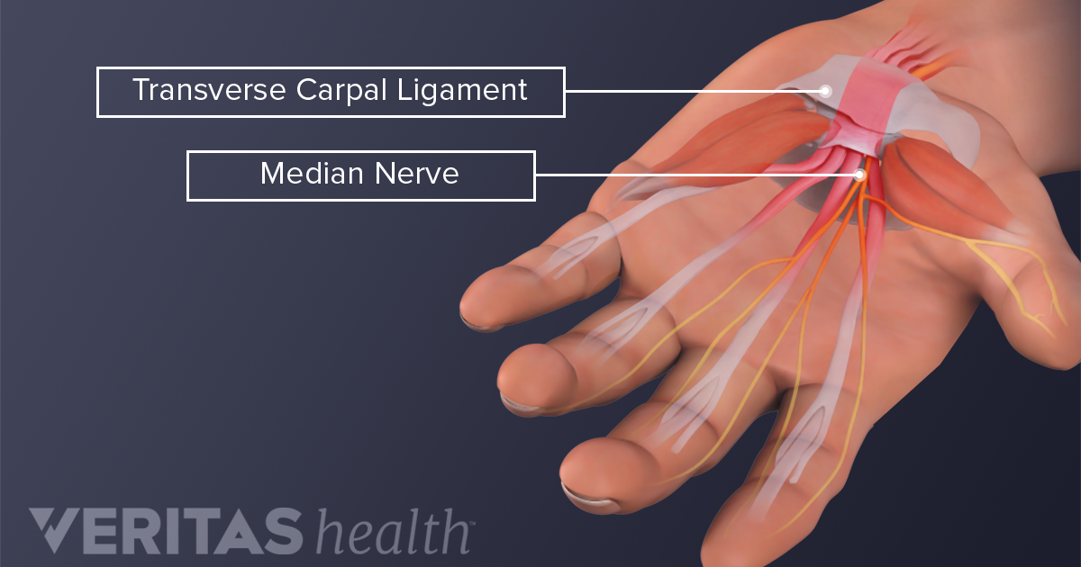 What Nerve Causes A Fist